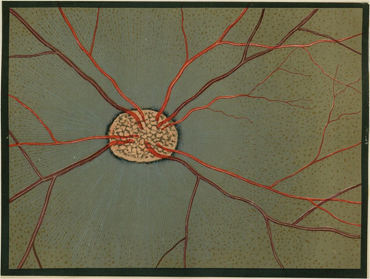 Tableau d'Acuité Visuelle Elite