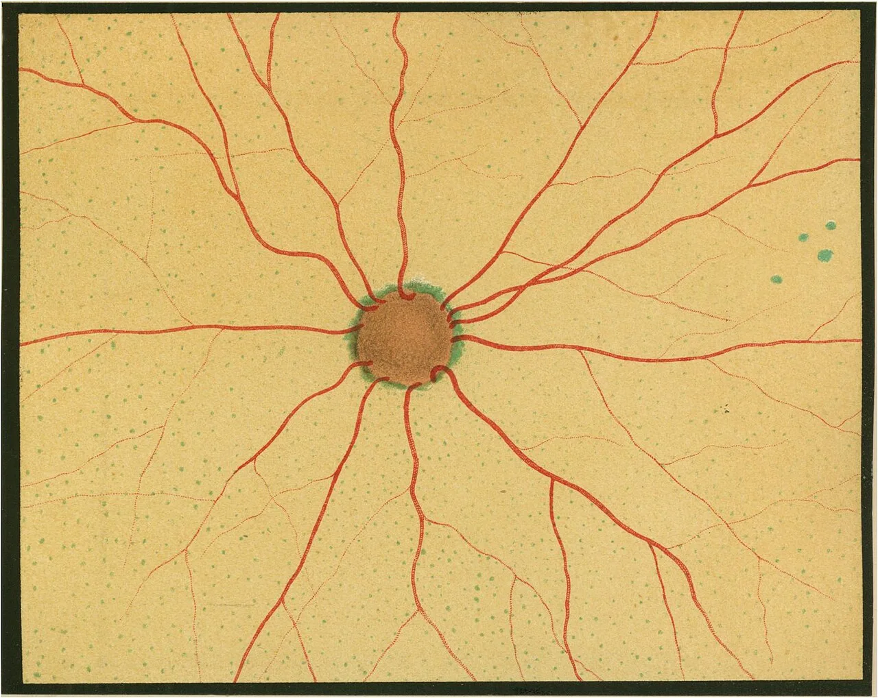 Périmètre de Champ Visuel 200