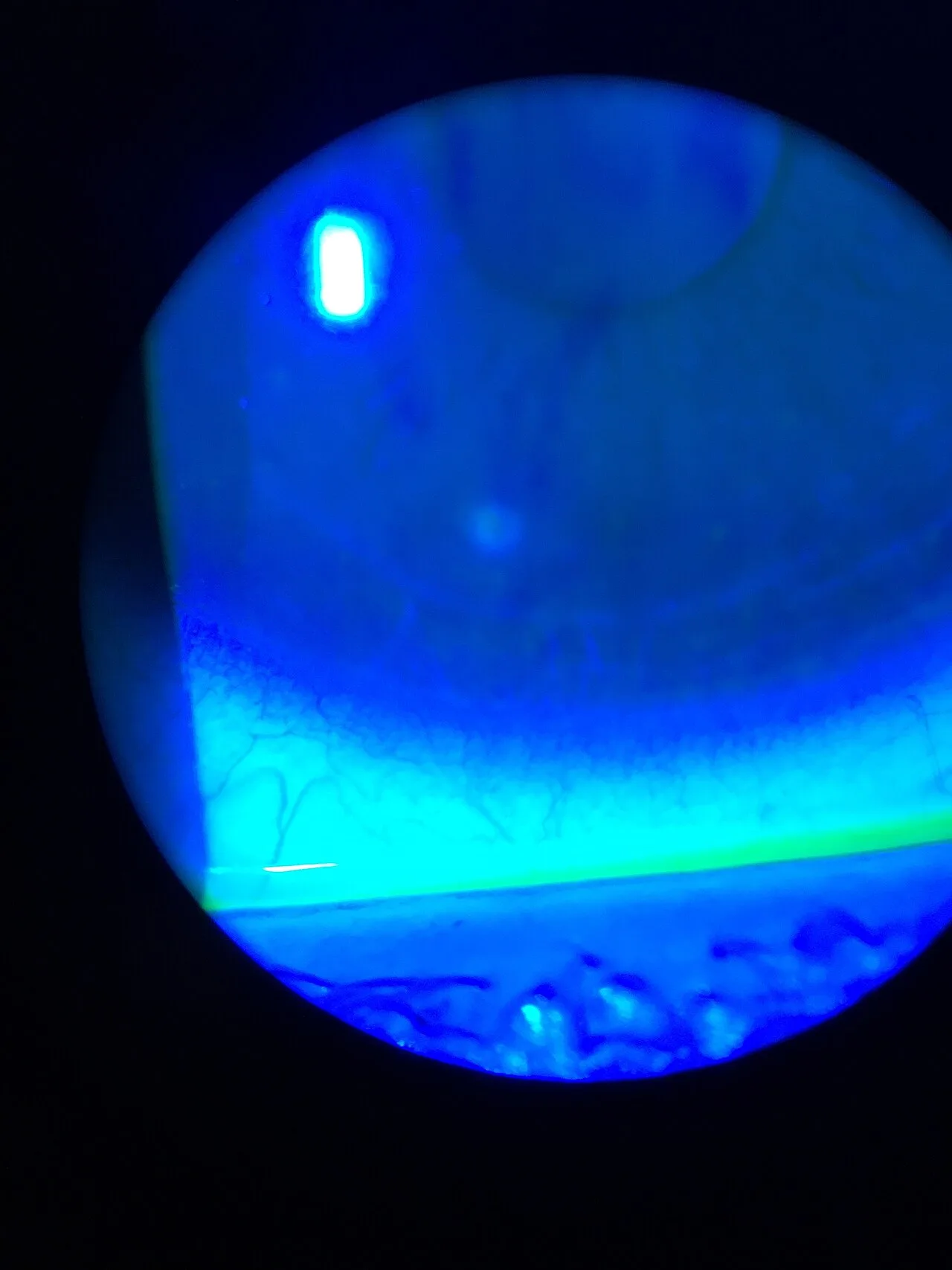 Rétinoscope Compact