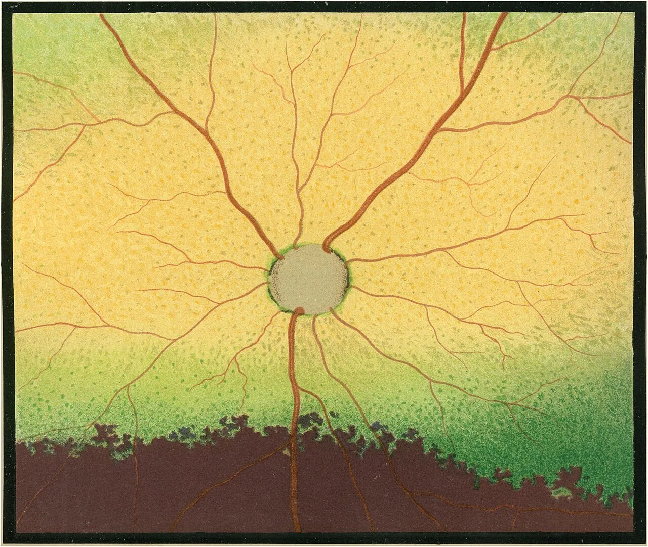 Tableau d'Acuité Visuelle 200