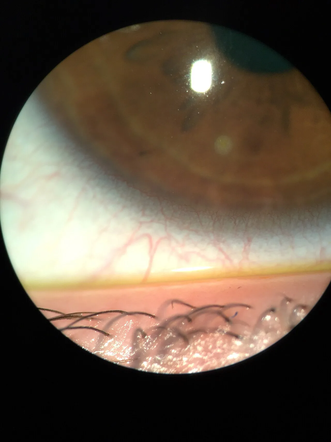 Ophtalmoscope Elite
